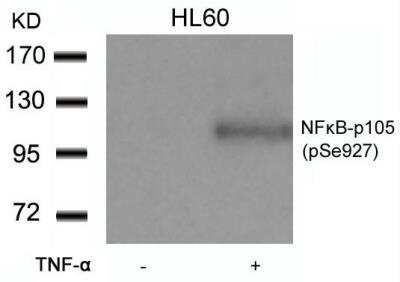 Western Blot: NFkB p105/p50 [p Ser927] Antibody [NB100-82069]
